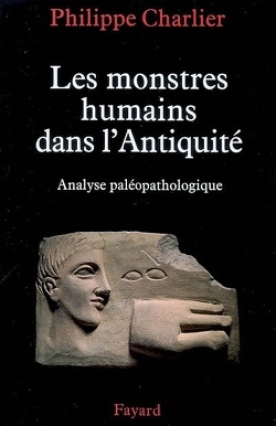Couverture de Les monstres humains dans l'Antiquité : analyse paléopathologique